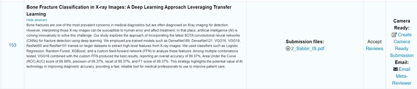Bone Fracture Classification in X-ray Images: A Deep Learning Approach Leveraging Transfer Learning